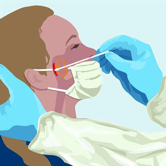 Nasopharyngealabstrichs